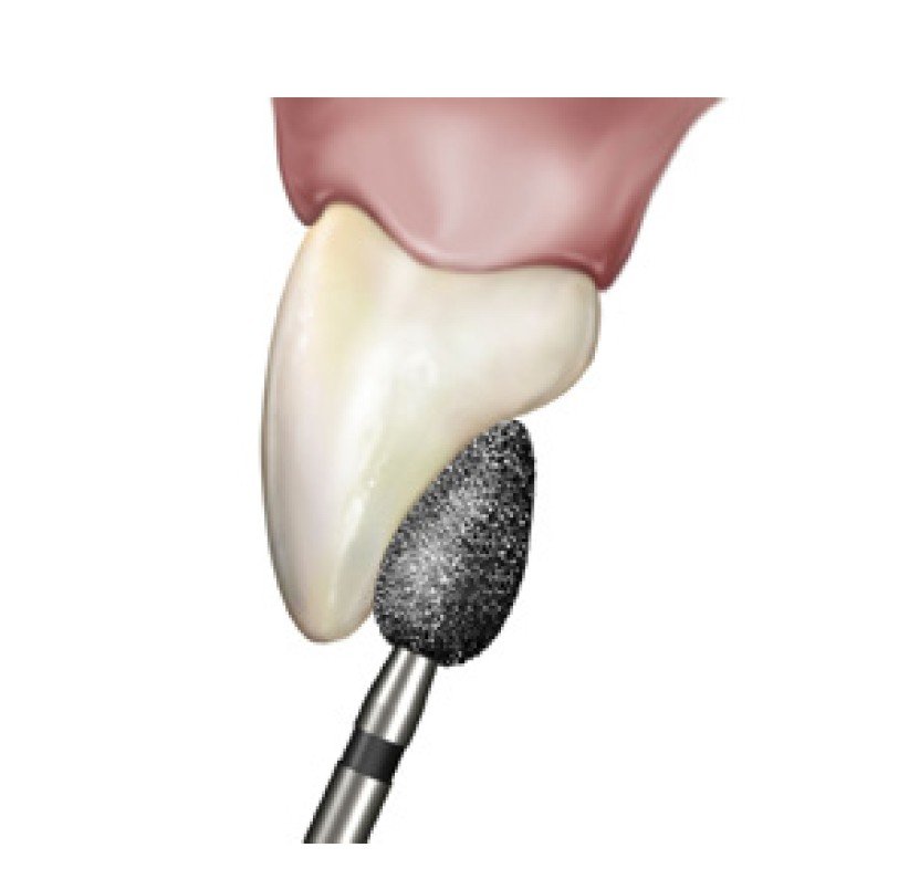 Fresa Football Diamante Alta Velocidad 379-023F-D84 - Imagen 2